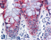 Anti-EPSTI1 Antibody (clone 2A8) IHC-plus LS-B4543