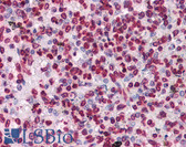 Anti-HIPK1 Antibody (clone 1D6) IHC-plus LS-B4549