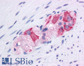 Anti-HSP90AA1 / Hsp90 Alpha A1 Antibody (aa108-157) IHC-plus LS-B4556