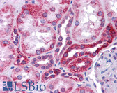 Anti-TP53 / p53 Antibody (N-Terminus) IHC-plus LS-B4557