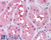 Anti-TP53 / p53 Antibody (N-Terminus) IHC-plus LS-B4558