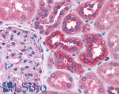 Anti-STAT6 Antibody (aa614-663) IHC-plus LS-B4560