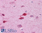 Anti-WNT5A Antibody (aa180-229) IHC-plus LS-B4565