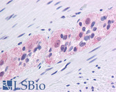 Anti-ZIF268 / EGR1 Antibody (aa30-79) IHC-plus LS-B4566