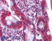 Anti-HNF4A / HNF4 Antibody (C-Terminus) IHC-plus LS-B4568