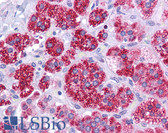 Anti-RAD51 / RECA Antibody (aa35-80) IHC-plus LS-B4573