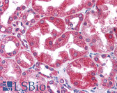 Anti-STAT3 Antibody (N-Terminus) IHC-plus LS-B4580