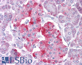 Anti-STAT1 Antibody (N-Terminus) IHC-plus LS-B4583