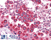 Anti-WNT2B Antibody (N-Terminus) IHC-plus LS-B4585