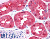 Anti-FAH Antibody (N-Terminus) IHC-plus LS-B4589