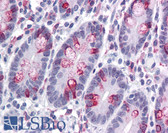 Anti-ZBED3 Antibody (N-Terminus) IHC-plus LS-B4602