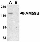 Anti-GAREML Antibody (C-Terminus) IHC-plus LS-B4621