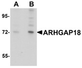 Anti-ARHGAP18 Antibody (C-Terminus) IHC-plus LS-B4628