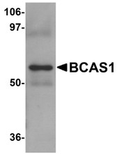 Anti-BCAS1 / NABC1 Antibody (C-Terminus) IHC-plus LS-B4631