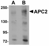 Anti-APCL / APC2 Antibody (Internal) IHC-plus LS-B4641