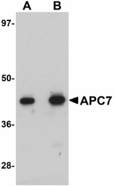 Anti-ANAPC7 / APC7 Antibody (C-Terminus) IHC-plus LS-B4646