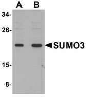 Anti-SUMO3 Antibody (C-Terminus) IHC-plus LS-B4650