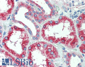 Anti-SLC11A2 / DMT1 Antibody (Internal) IHC-plus LS-A9281