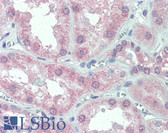 Anti-SLC11A2 / DMT1 Antibody (C-Terminus) IHC-plus LS-A9282