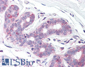 Anti-SLC39A6 / LIV-1 Antibody (N-Terminus) IHC-plus LS-A9283