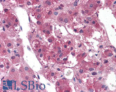 Anti-TM9SF1 Antibody (Internal) IHC-plus LS-A9224