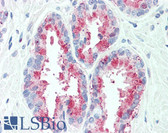 Anti-TSPAN13 / TM4SF13 Antibody (Internal) IHC-plus LS-A8852