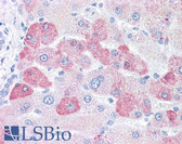 Anti-LOXL2 Antibody (N-Terminus) IHC-plus LS-A9354