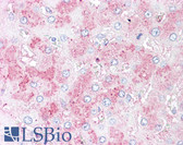 Anti-SLITRK6 Antibody (N-Terminus) IHC-plus LS-A9247
