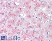 Anti-SLITRK6 Antibody (Internal) IHC-plus LS-A9245