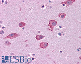 Anti-HGF Antibody (aa216-265) IHC-plus LS-B4657