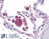 Anti-KITLG / SCF Antibody (aa180-229) IHC-plus LS-B4658