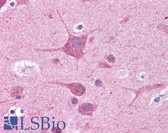 Anti-RORC / ROR Gamma Antibody (aa110-159) IHC-plus LS-B4659