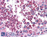 Anti-MAGEA3 Antibody (aa216-265) IHC-plus LS-B4662