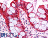 Anti-FABP1 / L-FABP Antibody (N-Terminus) IHC-plus LS-B4666