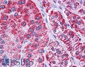 Anti-HADHB Antibody (aa351-400) IHC-plus LS-B4668