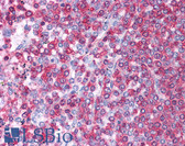 Anti-HSPA8 / HSC70 Antibody (aa143-192) IHC-plus LS-B4670
