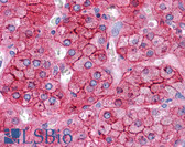 Anti-APOE / Apolipoprotein E Antibody (N-Terminus) IHC-plus LS-B4680