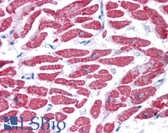Anti-GPX4 / MCSP Antibody (aa72-121) IHC-plus LS-B4687