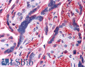 Anti-UCHL3 Antibody (N-Terminus) IHC-plus LS-B4688