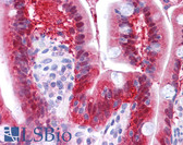 Anti-NME1 Antibody (N-Terminus) IHC-plus LS-B4689