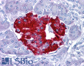 Anti-BLIMP1 / PRDM1 Antibody (aa611-660) IHC-plus LS-B4694