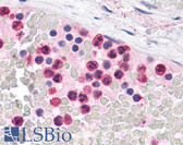 Anti-TLR4 Antibody (C-Terminus) IHC-plus LS-B4696