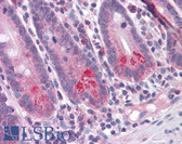 Anti-BRUCE / BIRC6 Antibody (C-Terminus) IHC-plus LS-B4702