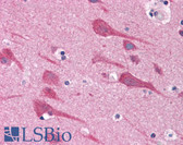 Anti-TAB2 Antibody (C-Terminus) IHC-plus LS-B4704