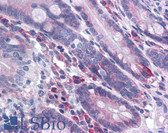 Anti-DISP2 Antibody (N-Terminus) IHC-plus LS-B4713