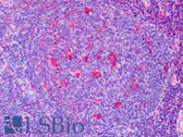 Anti-MMP9 / Gelatinase B Antibody IHC-plus LS-B4744