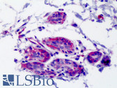 Anti-PRLR / Prolactin Receptor Antibody (clone B6.2) IHC-plus LS-B4747