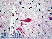 Anti-FBXW7 / FBW7 Antibody (N-Terminus) IHC-plus LS-B4758