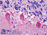 Anti-YWHAB / 14-3-3 Beta Antibody IHC-plus LS-B4793
