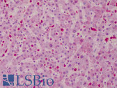 Anti-CARMA1 / CARD11 Antibody IHC-plus LS-B4794